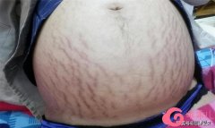 [field:title/]